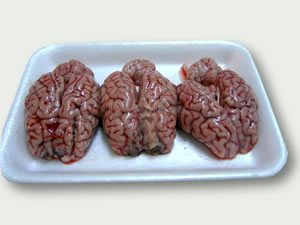 Cervells xai